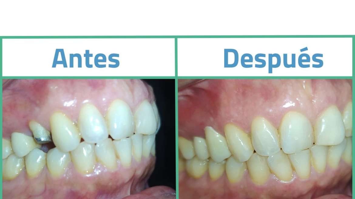 Rehabilitación Oral